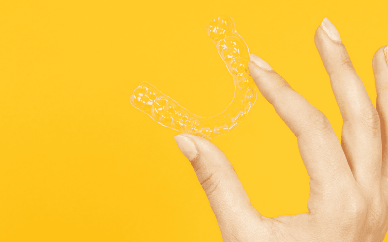 You are currently viewing Teeth Aligners Ultimate Guide 2022