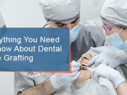 Everything You Need to Know About Dental Bone Grafting