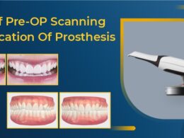 Use Of Pre-Operative Scanning In Fabrication Of Prosthesis