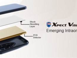 Xpect Vision – Emerging Intraoral Sensor