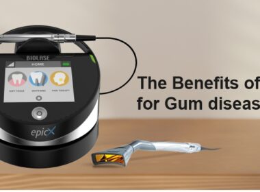 The Benefits of Laser for Gum Disease